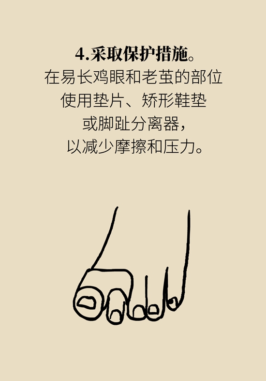 长了鸡眼该怎么办四大妙招教给你,长了鸡眼怎么治疗好得快