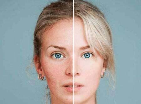 皮肤泛红敷面膜能改善吗,皮肤管理敷膜为什么要用纱布