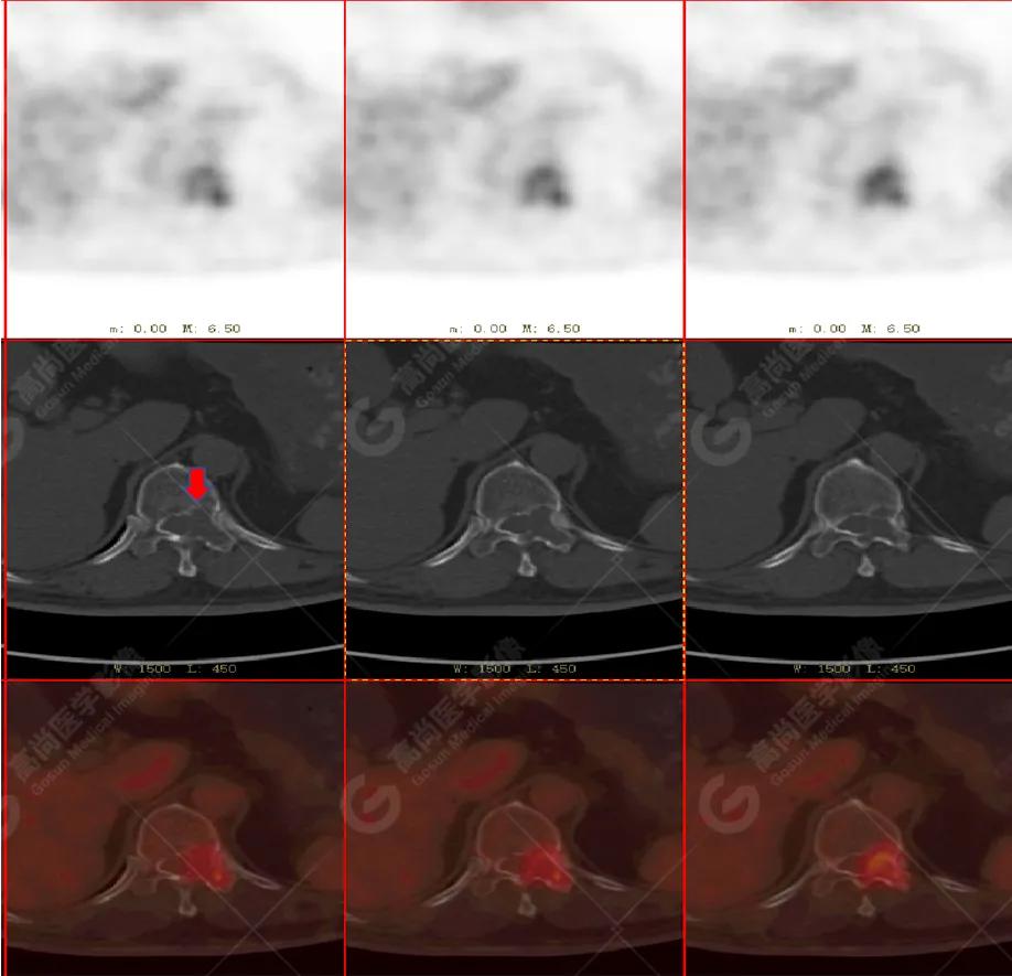 女性防癌检查科普,妇女宫颈癌及乳腺癌筛查情况年报