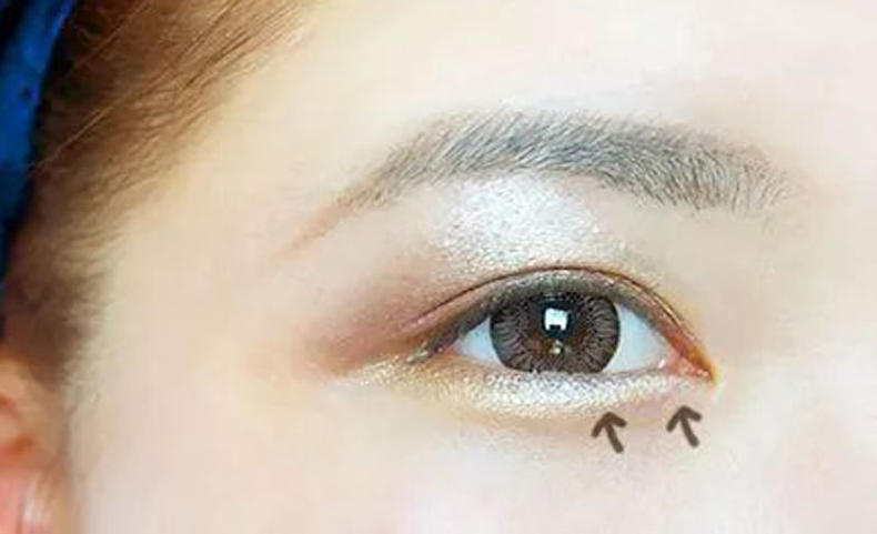 脸部凹陷怎么变饱满护肤,脸部衰老凹陷怎么恢复饱满