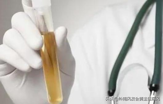 有哪些症状的人容易得高尿酸血症,尿酸高的人身上会有四种迹象