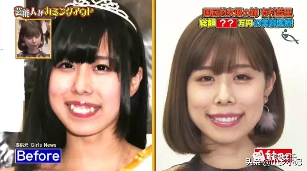 明明是整容脸现在却成了颜值巅峰,明明是整容脸却没被吐槽过