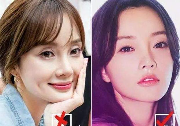 云南双眼皮失败,南华博士整形