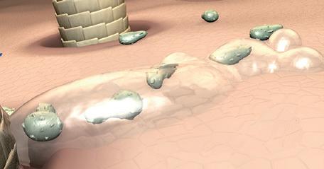 头皮屑多怎样解决最有效,头皮屑多怎么办最有效