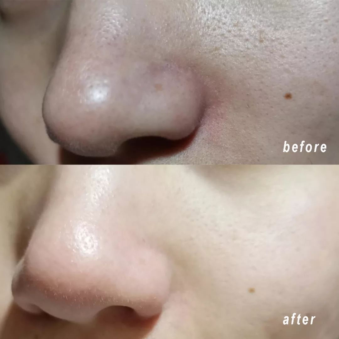 清洁面膜测评踩雷,清洁面膜测评排行榜前十位