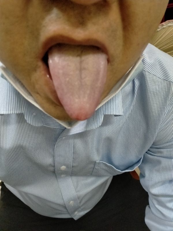 血压为什么这么难控制,血压高有什么好方法快速降压