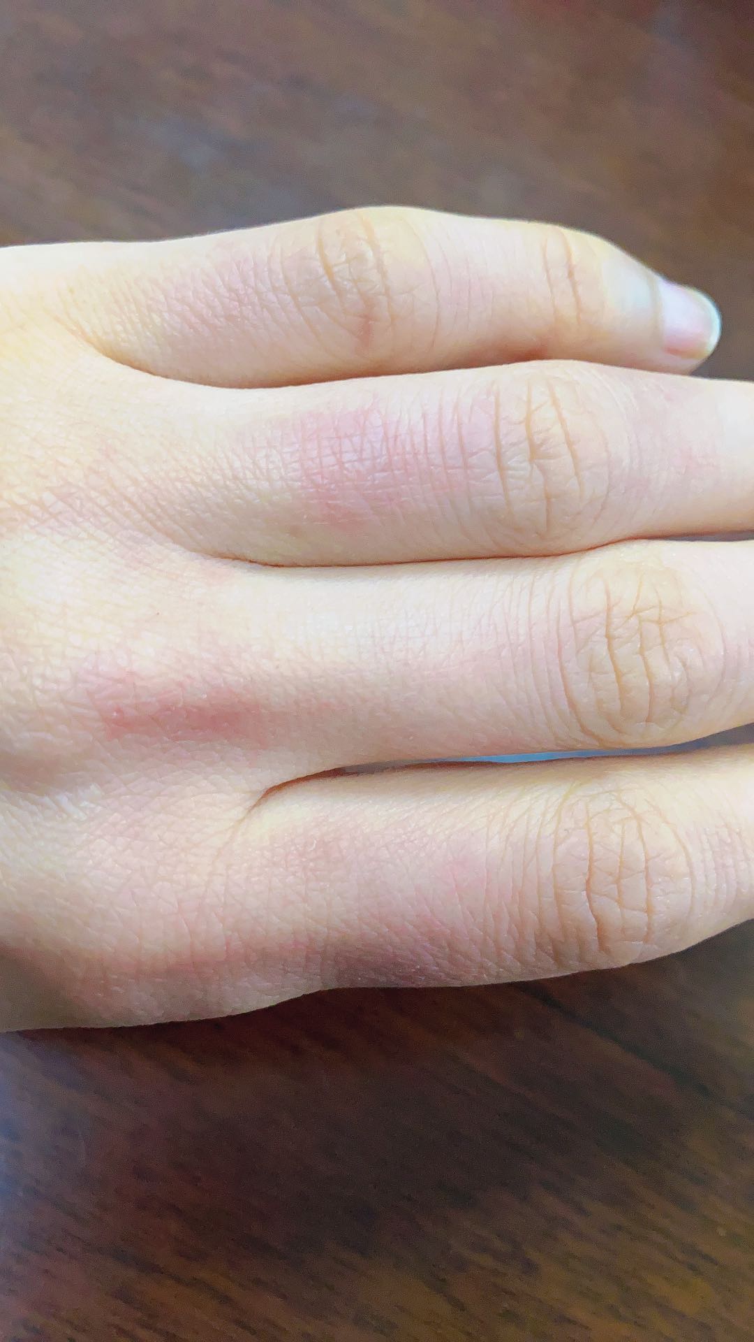 疫情期间频繁洗手的你要小心了,洗完手还要涂护手霜的更要小心了