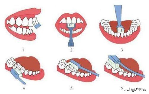 疫情期间怎么预防口腔病,疫情期间哪些口腔问题需及时就诊