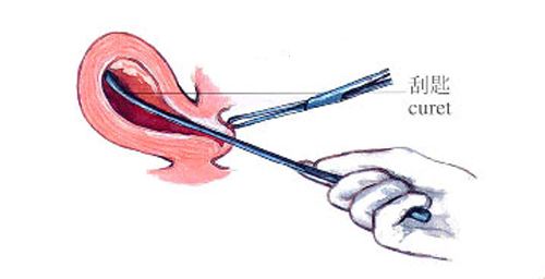 女性生产的后遗症,生产后女性容易患上的疾病