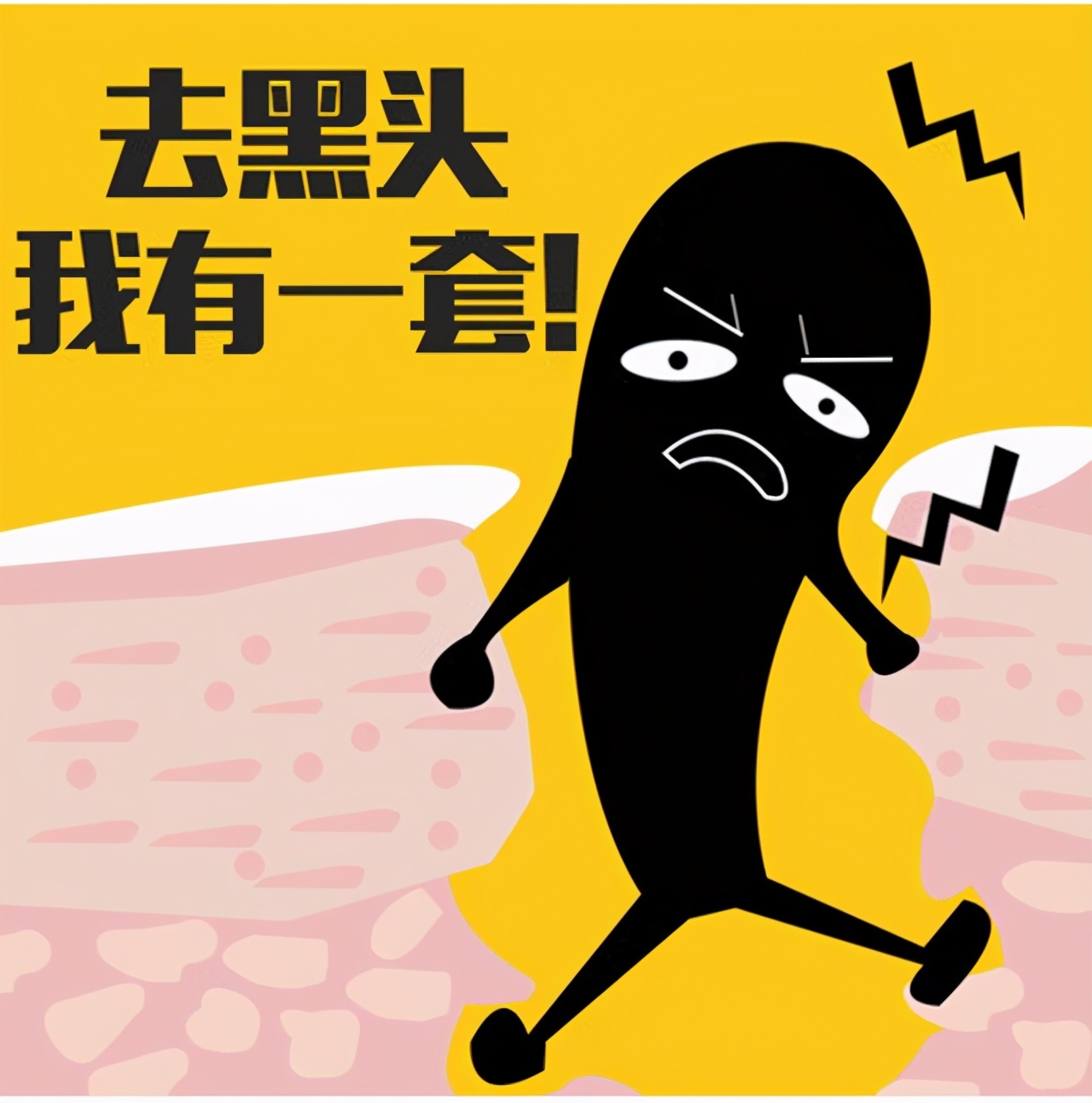 激光祛黑头真的可以去除吗,激光治疗黑头毛孔粗大多少钱