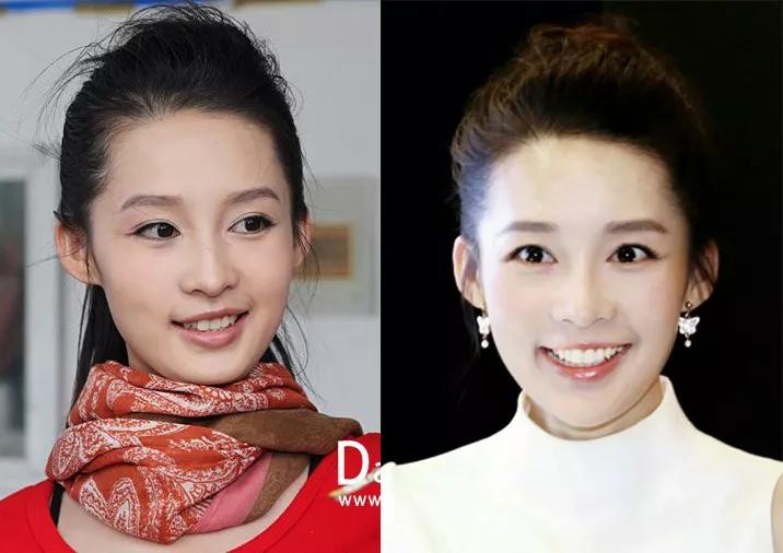 怎样让脸五官看着舒服,五官不太精致的女生变美