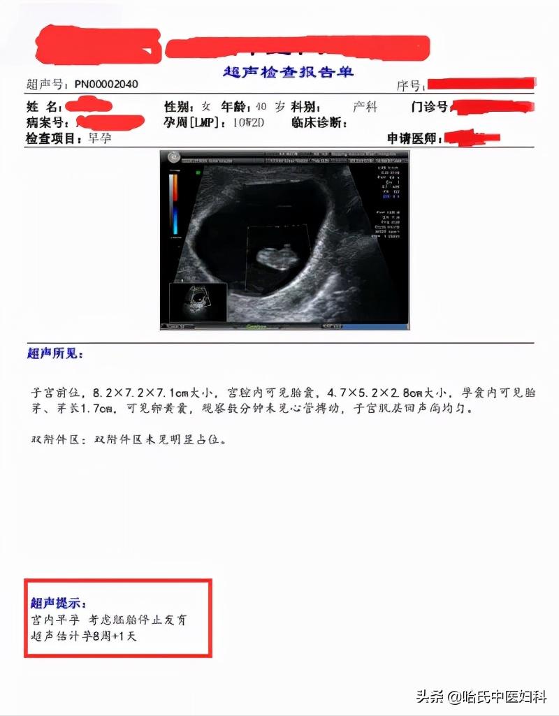 不孕胎停,不孕试管失败