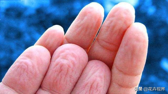 为什么手泡在水里泡久了会褶皱,手在水里泡一会就皱巴巴是为什么