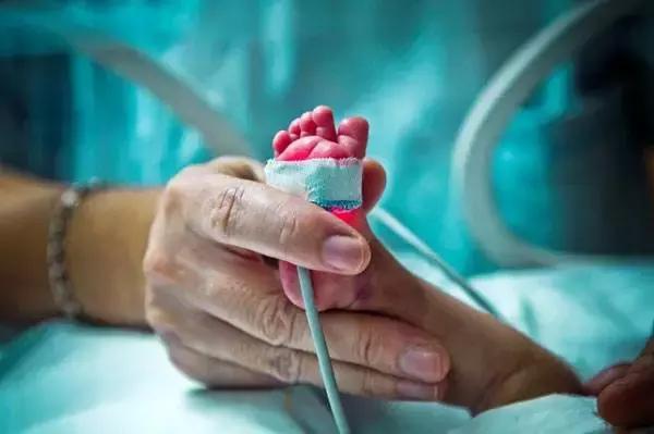 27周早产儿治疗过程,27周早产儿救治费用