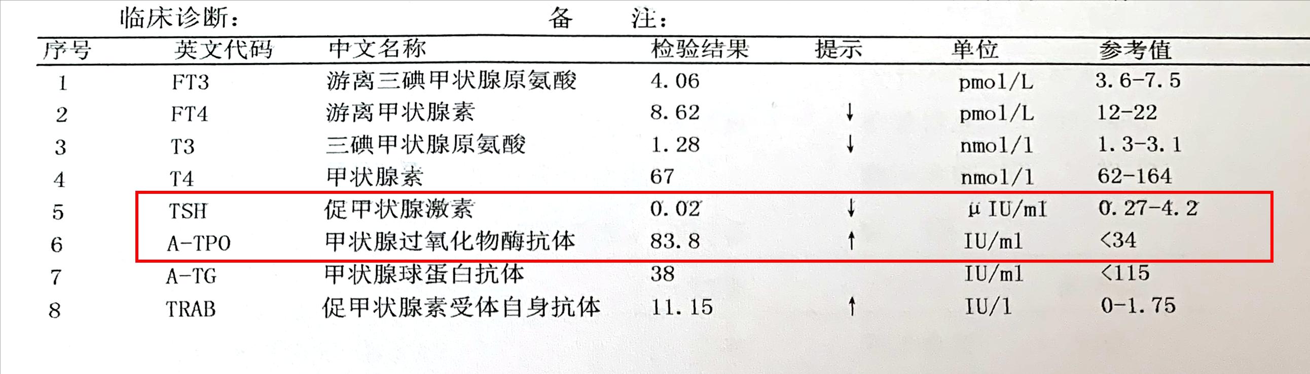 甲亢眼突最新治疗方法,甲亢突眼越来越严重的表现