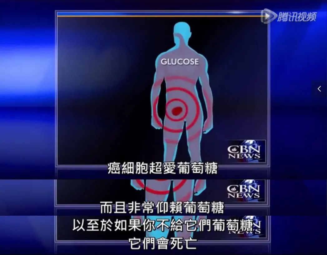 乳腺癌15种锻炼方法,断食或能阻挡乳腺癌发展