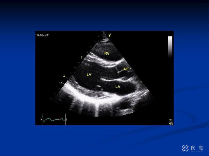 iseihealth:日本高精度的“3个PSA测定”前列腺癌检测纳入保险