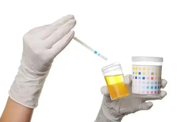 做尿常规前一定要知道这7件事，否则检查结果会出现很大误差