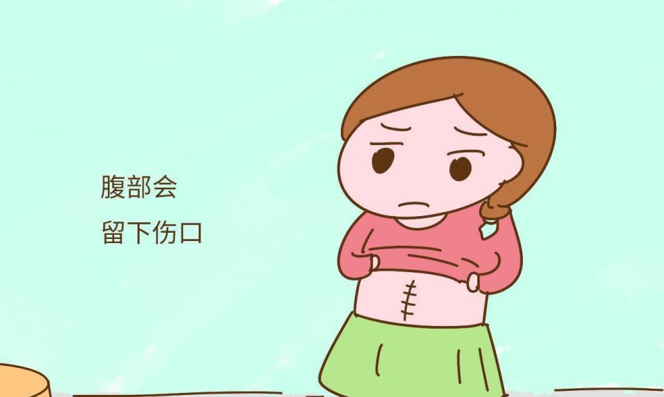 为什么现在女性都选择剖腹产?剖腹产和顺产的优缺点,一次性说清