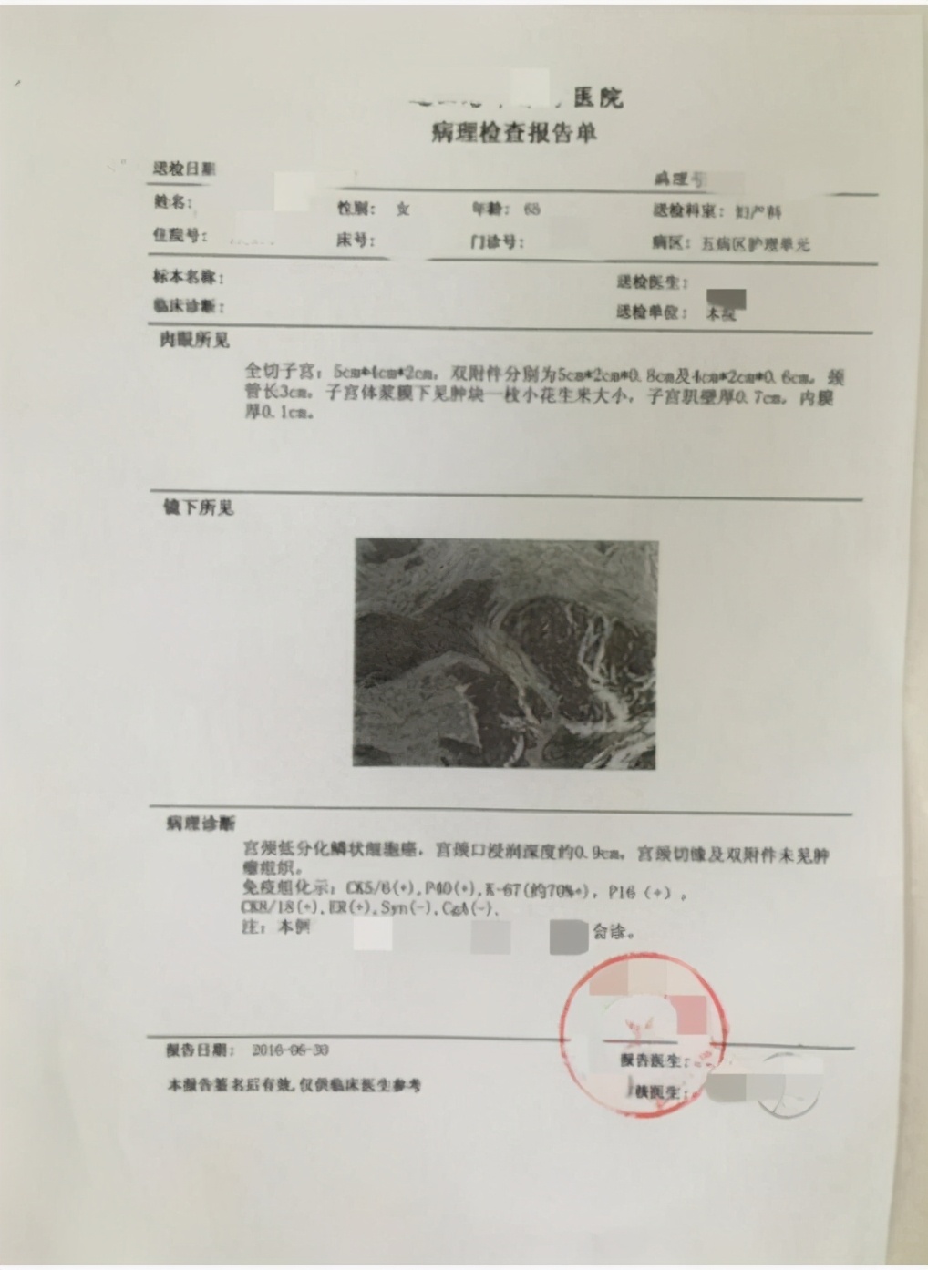 一分钟看懂宫颈癌筛查方法,一分钟看懂宫颈癌预后