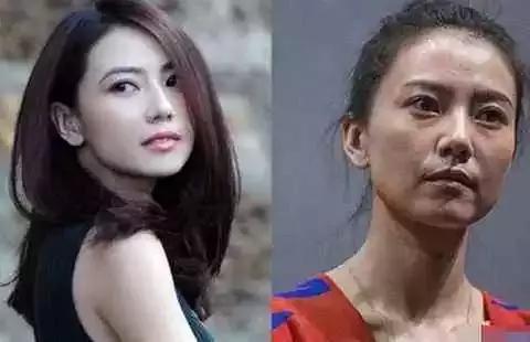 黑眼圈一定是熬夜造成的吗,有黑眼圈但是一定要熬夜怎么办