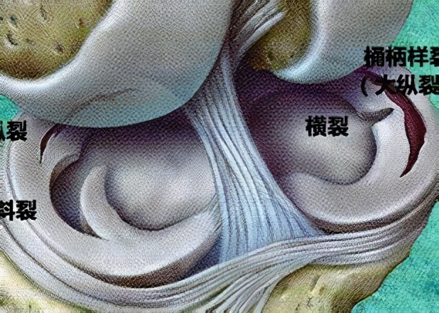 谈“骨”论“筋”|膝盖又疼了?来教你几个康复锻炼方法