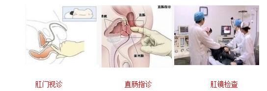 肠炎肛瘘的症状及治疗,肛瘘引起的脓包怎么办