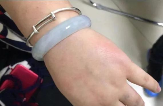 手镯戴了可以随意取吗,手镯戴手上取不下来怎么鉴定真假