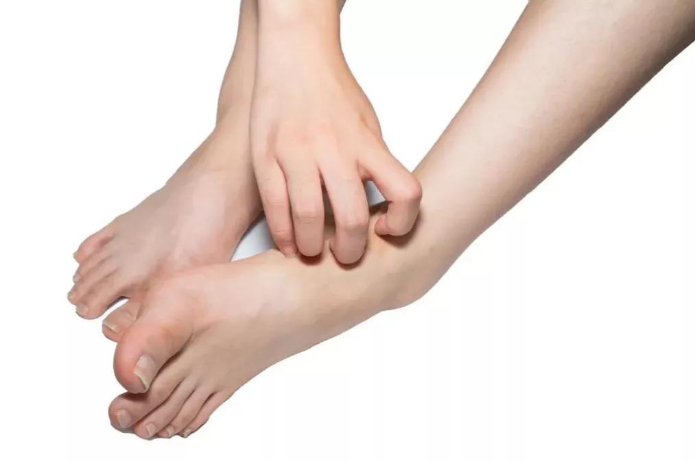 天气一热脚就脚臭？教你5招，远离脚气