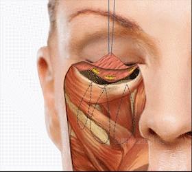 40多岁眼袋很重，还有泪沟该怎么办？听听医生怎么说...