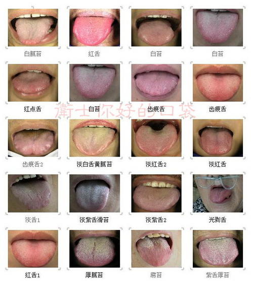 望舌知病实操完整版,教你看舌辨病