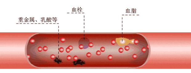 人少一个肾对身体有什么影响,男人少了一个肾有什么影响