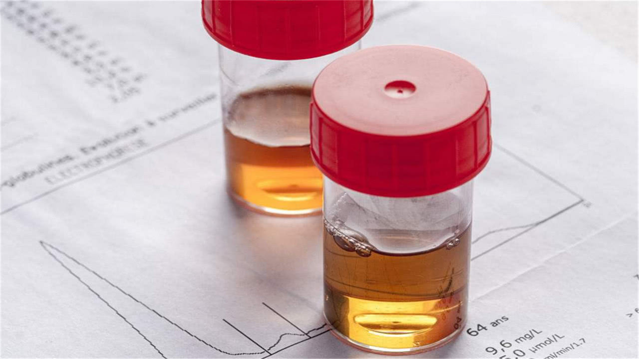 女人晨起第一泡尿，若没有4个表现，偷着笑吧，表明子宫还算健康