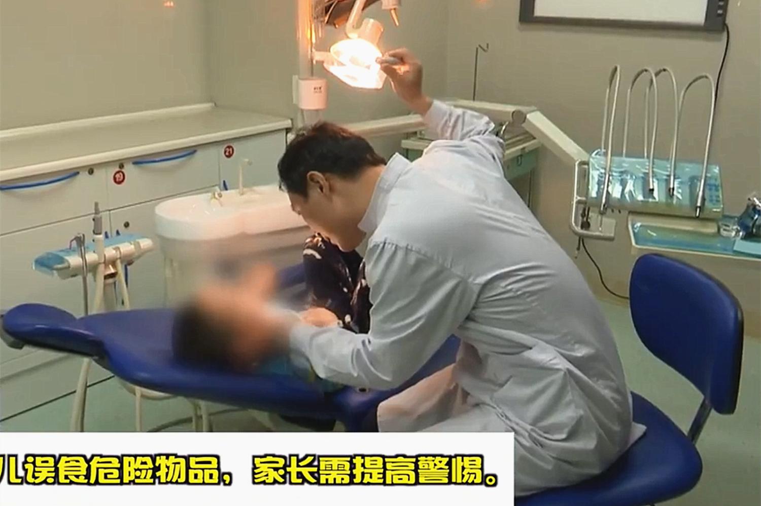 一岁半宝宝误食502胶，好在妈妈淡定处理，医生：妈妈机智