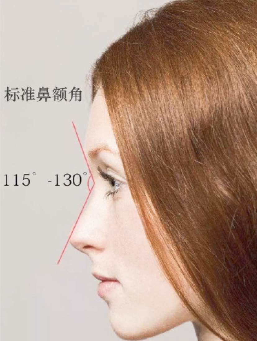 女人鼻子图解通天鼻,肋骨鼻做成了通天鼻怎么改