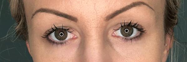 长期开车眼睛疲劳有什么好办法,长期开车有助于恢复视力