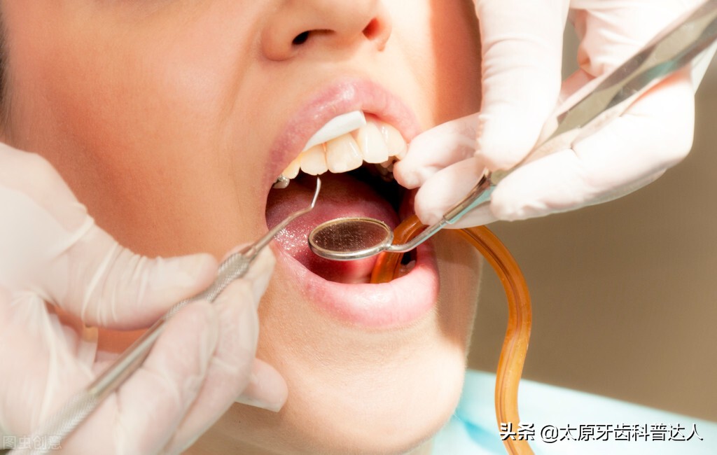 蛀牙是被虫子吃空的吗,蛀牙的虫子是什么样的