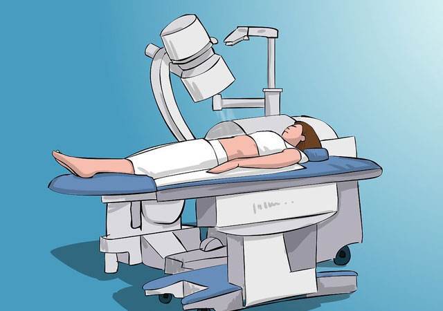 做完体外碎石为什么总大便,体外碎石后出现结石的原因