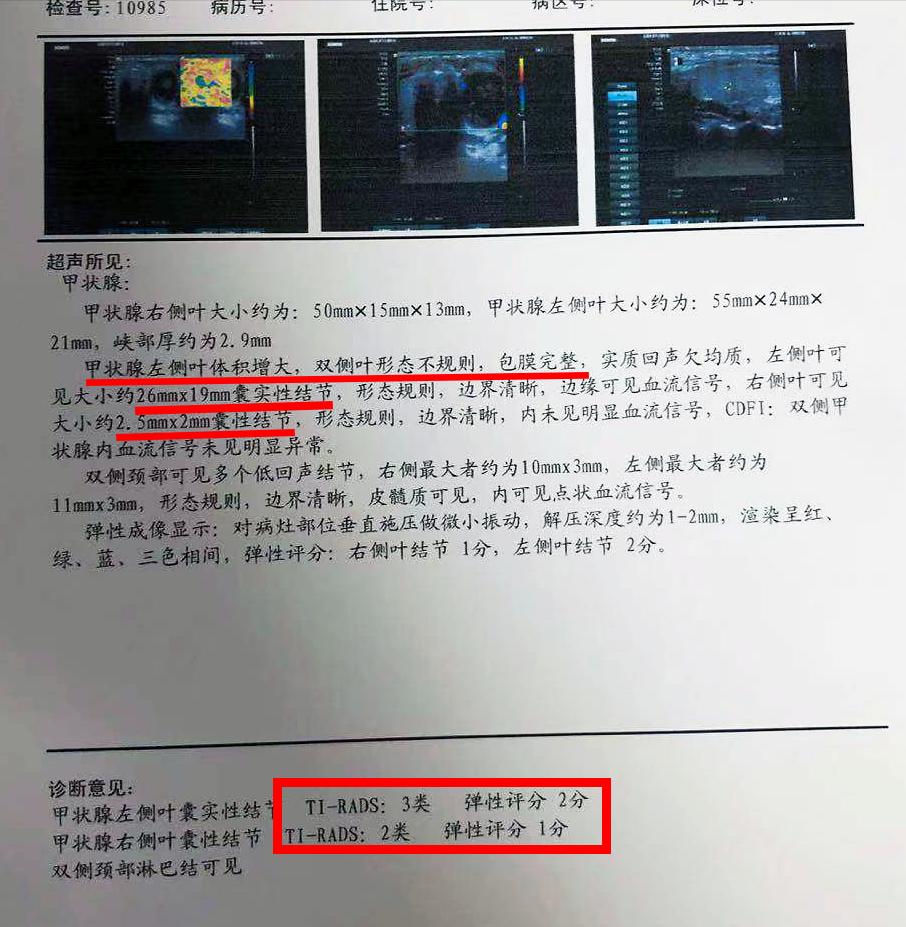 甲状腺结节偏方蒲公英,甲状腺结节4a类农村偏方