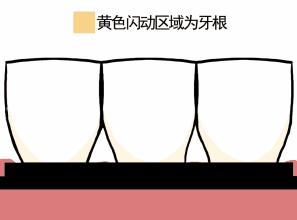 【科普】中年焦虑，我的牙齿怎么“变长”了？