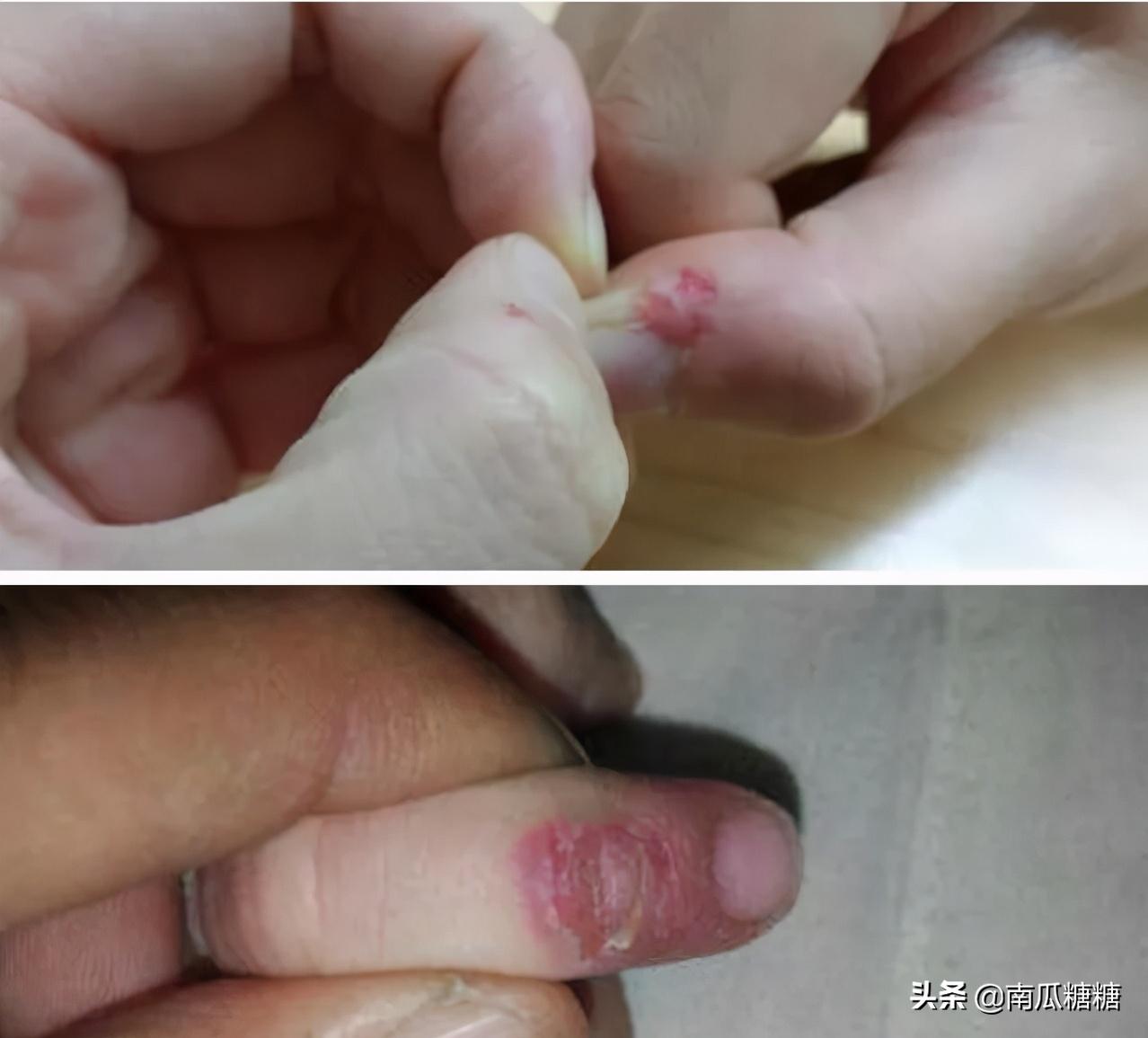 小孩抠手指头皮是缺什么,小孩儿总抠手指头是缺哪种维生素