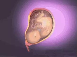 宝宝腿不矫正怎么办,宝宝腿不伸展怎么办