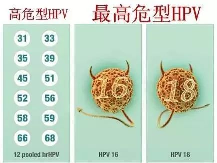 关于HPV，你了解多少？
