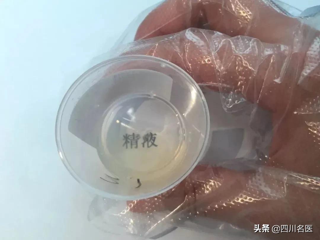 精子是如何产生的百科,精子是不是每天都能生成