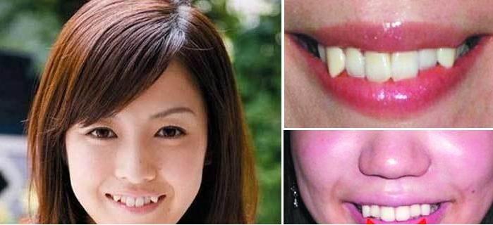 为什么会有长牙的情况,为什么有的人长牙快有的人长牙慢