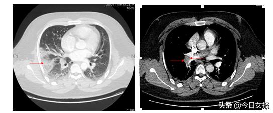 大学生熬夜打游戏抢救无效,20岁小伙通宵打游戏抢救