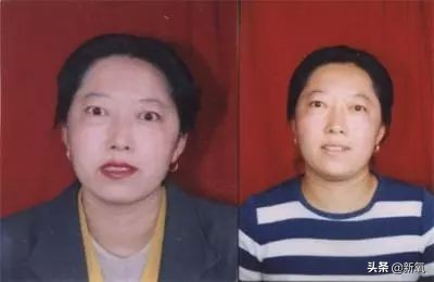 抢了刘亦菲干爹还发博踩天仙，但她这个部位肿得惊人