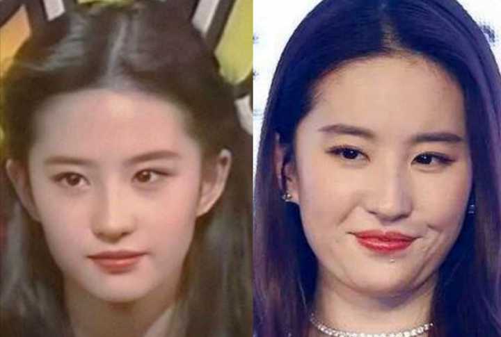 咬肌型发腮怎么改善,大脸方脸女生如何快速改变脸型