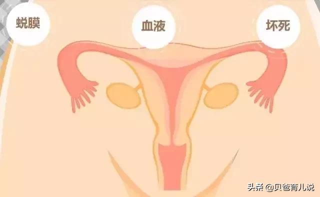 产后恢复那点事：如何判断子宫恢没恢复好？大姨妈啥时候来报道？