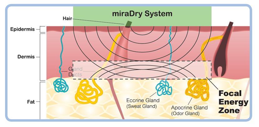 最让多汗人士尴尬的问题，一篇全解决